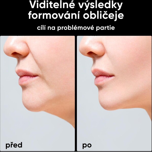 JOVS-Slimax-mikroproudovy-omlazujici-pristroj
