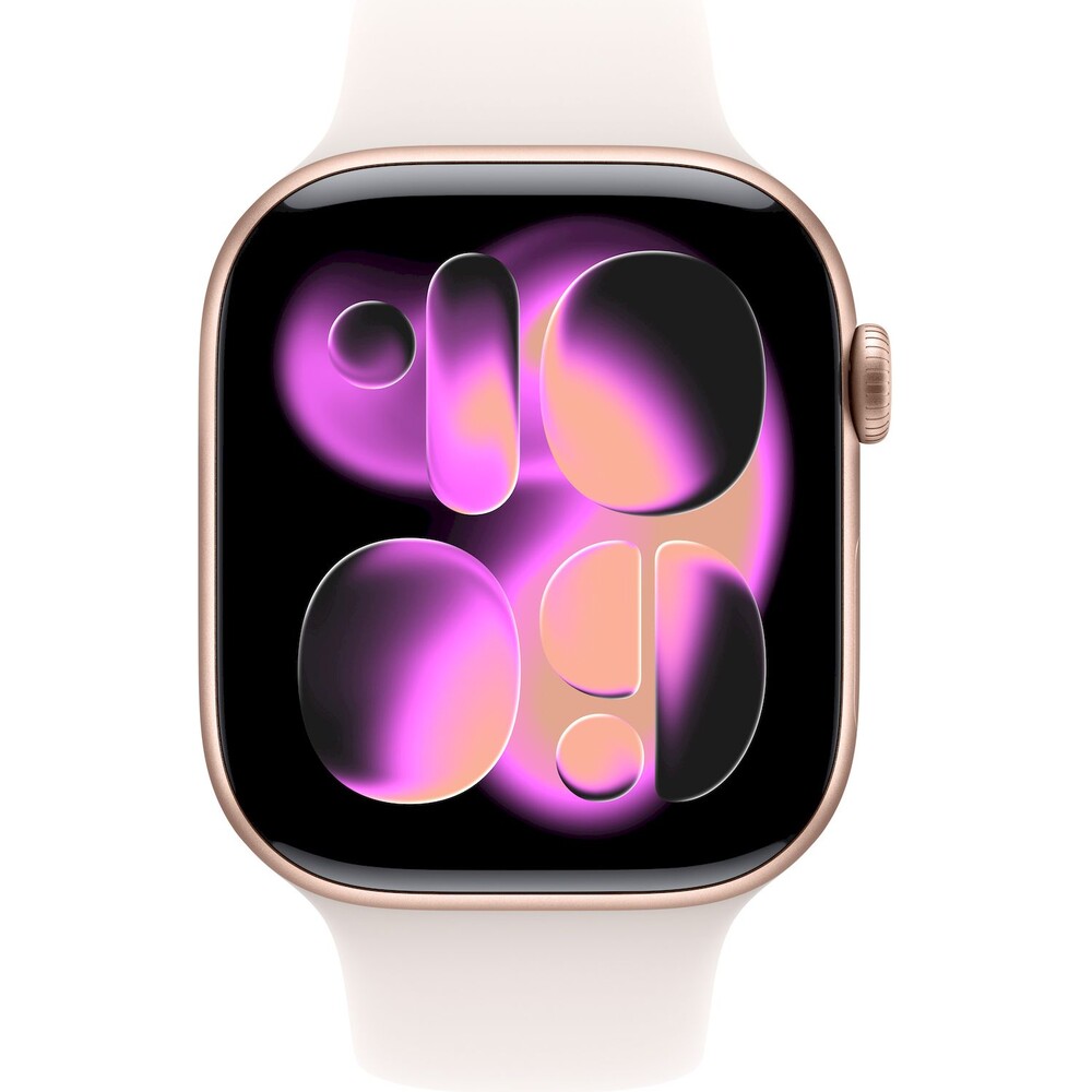 Apple-Watch-Series-11-Cellular-42mm-Ruzove-zlaty-hlinik-se-svetle-rumenym-sportovnim-reminkem-M-L