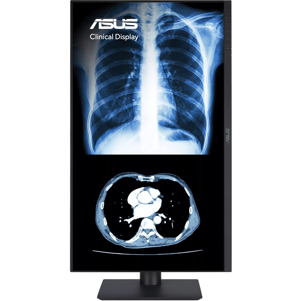 ASUS-MH2441A-klinicky-monitor-24-