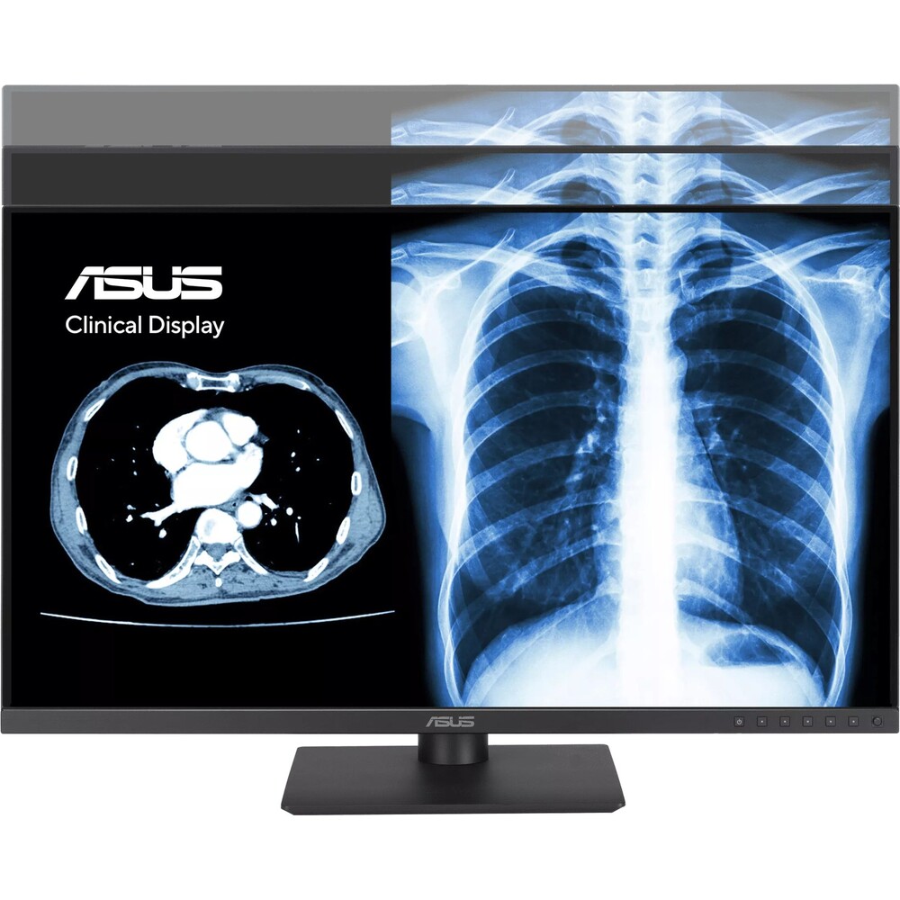 ASUS-MH2441A-klinicky-monitor-24-