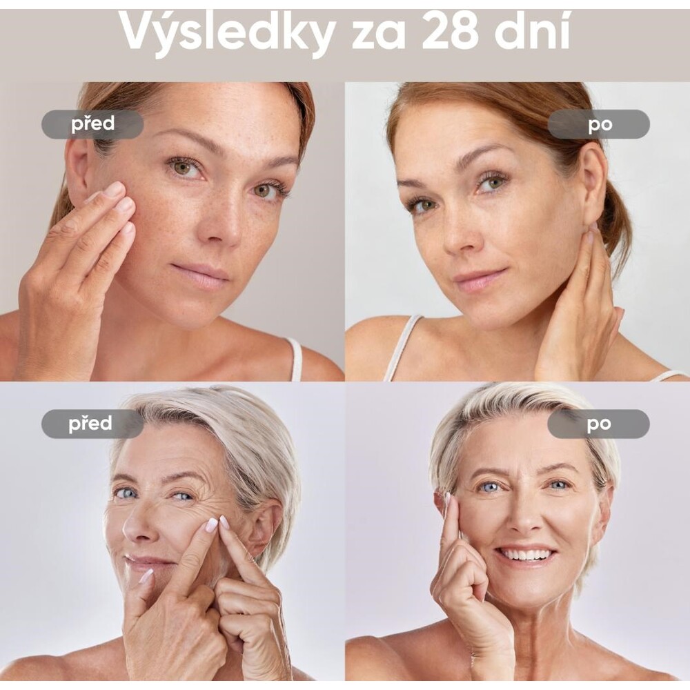 JOVS-4D-v2-laserova-svetelna-terapeuticka-maska