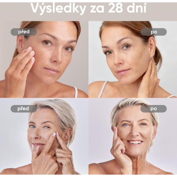 JOVS-4D-v2-laserova-svetelna-terapeuticka-maska